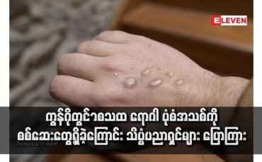 Embedded thumbnail for ကွန်ဂိုတွင် mpox ရောဂါ ပုံစံအသစ်ကို စစ်ဆေးတွေ့ရှိခဲ့ကြောင်း သိပ္ပံပညာရှင်များ ပြောကြား